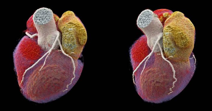 Chestrad Astra Radiology provides the first Dual Source CT scanner in Auckland ...